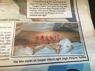 Newspaper article about shark attack