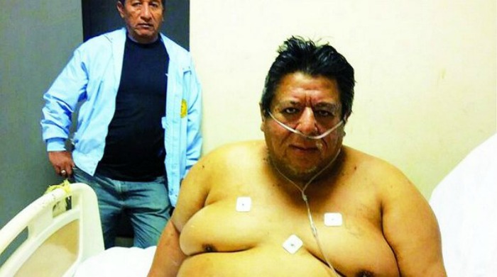 El hombre más obeso del Perú se encuentra en Tumbes y está enfermo