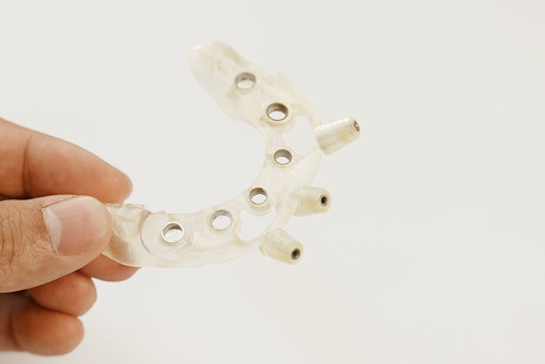 黃泓傑醫師介紹植牙的好幫手－手術導板 (4)